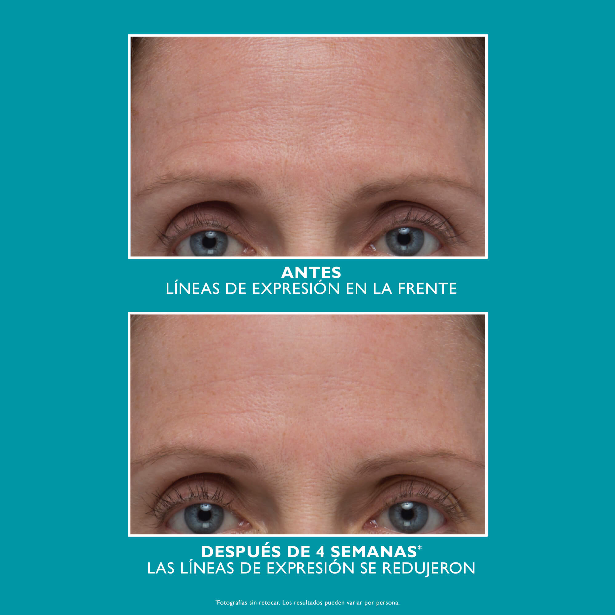 PEPTIDE SKINJECTION™ AMPLIFIED WRINKLE-FIX REFILLABLE SERUM (SUERO LIGERO)